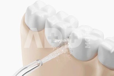 Xiaomi Water Flosser 2 200ml, white